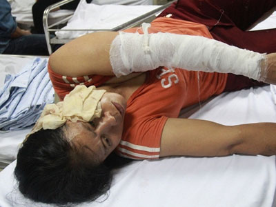Ảnh bìa bài viết 356163