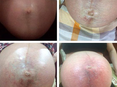 Ảnh bìa bài viết 362251