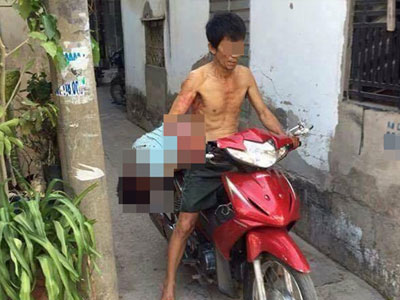 Ảnh bìa bài viết 362569