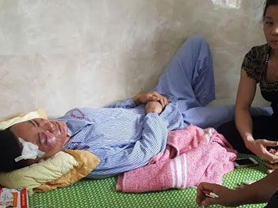 Ảnh bìa bài viết 368910