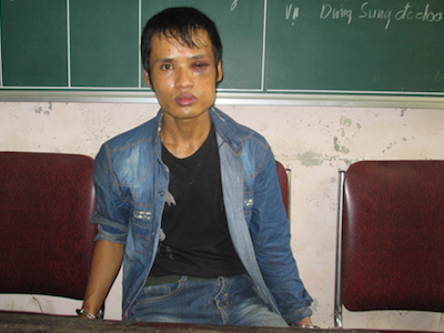 Ảnh bìa bài viết 371513
