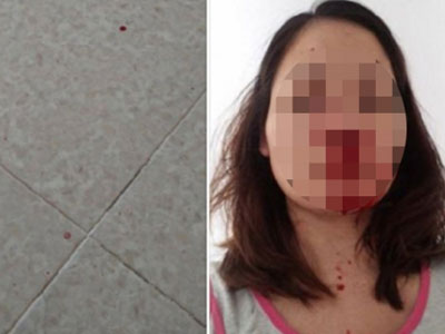 Ảnh bìa bài viết 375352