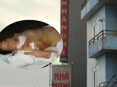 Ảnh bìa bài viết 383588