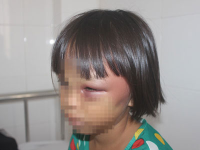 Ảnh bìa bài viết 385357