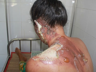 Ảnh bìa bài viết 386906