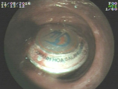 Ảnh bìa bài viết 387388