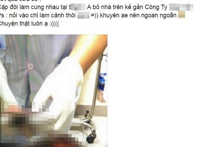 Ảnh bìa bài viết 390202