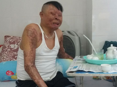 Ảnh bìa bài viết 403134