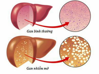 Ảnh bìa bài viết 410625