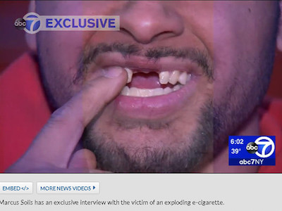 Ảnh bìa bài viết 416501