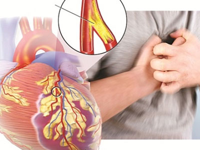 Ảnh bìa bài viết 423257
