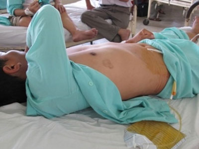 Ảnh bìa bài viết 426292