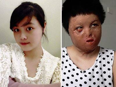 Ảnh bìa bài viết 428130