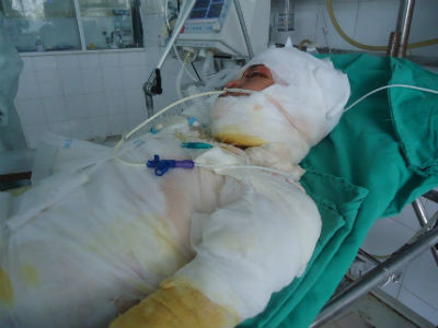 Ảnh bìa bài viết 433506