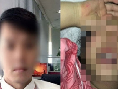 Ảnh bìa bài viết 437707