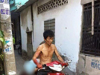 Ảnh bìa bài viết 442129