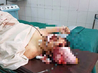 Ảnh bìa bài viết 443595