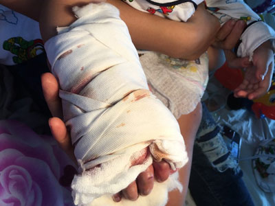 Ảnh bìa bài viết 443889