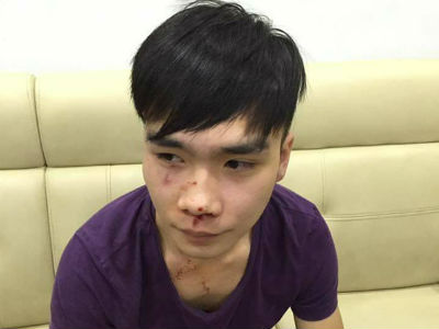 Ảnh bìa bài viết 444175