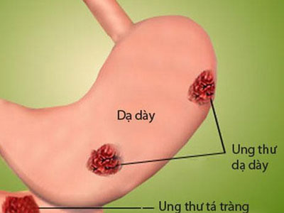 Ảnh bìa bài viết 446033