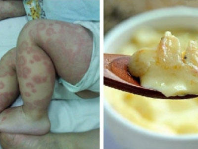 Ảnh bìa bài viết 448579