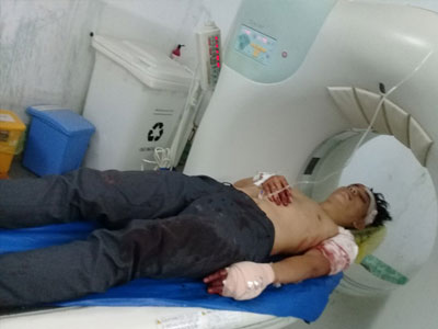 Ảnh bìa bài viết 449874