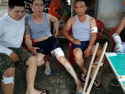 Ảnh bìa bài viết 450547