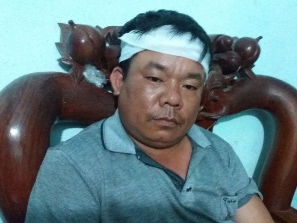 Ảnh bìa bài viết 452461
