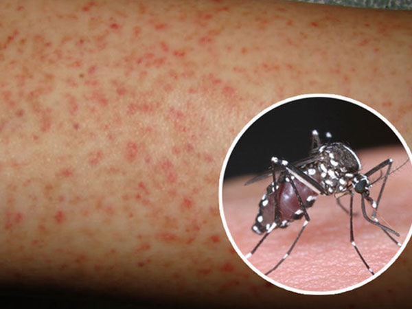 Ảnh bìa bài viết 454595