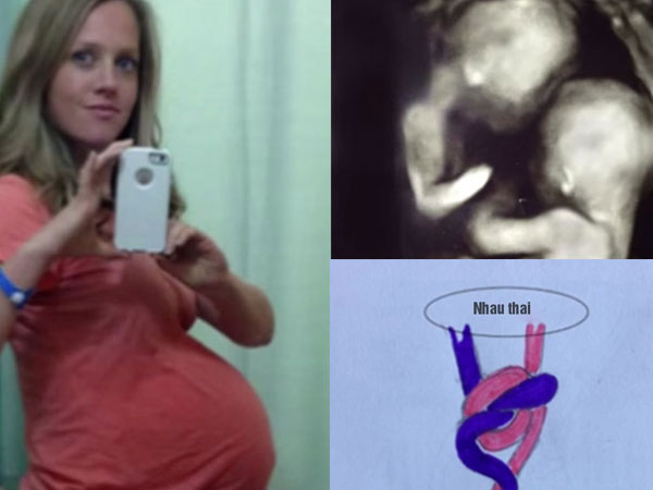 Ảnh bìa bài viết 455317