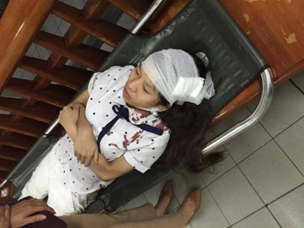 Ảnh bìa bài viết 462666