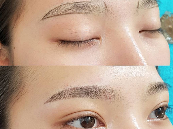 Ảnh bìa bài viết 472011