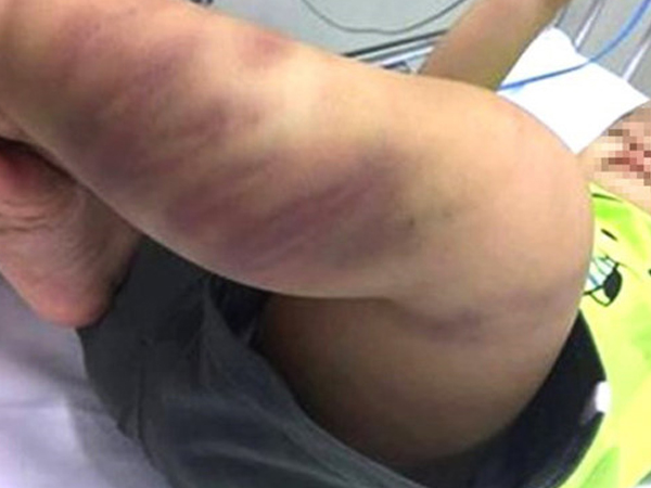 Ảnh bìa bài viết 472637