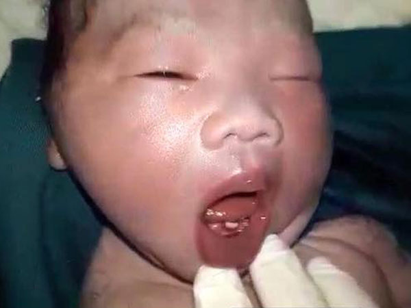 Ảnh bìa bài viết 473749