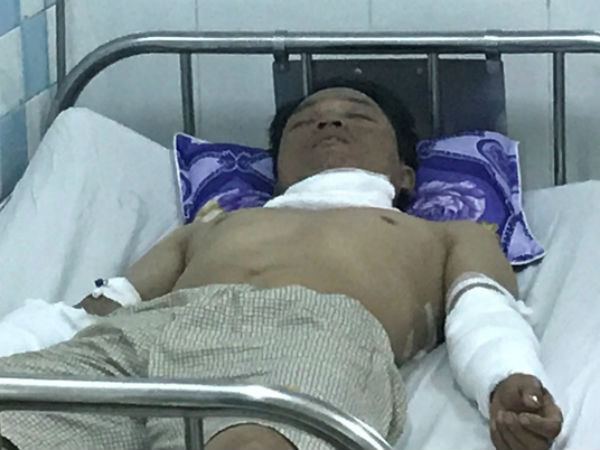 Ảnh bìa bài viết 474151