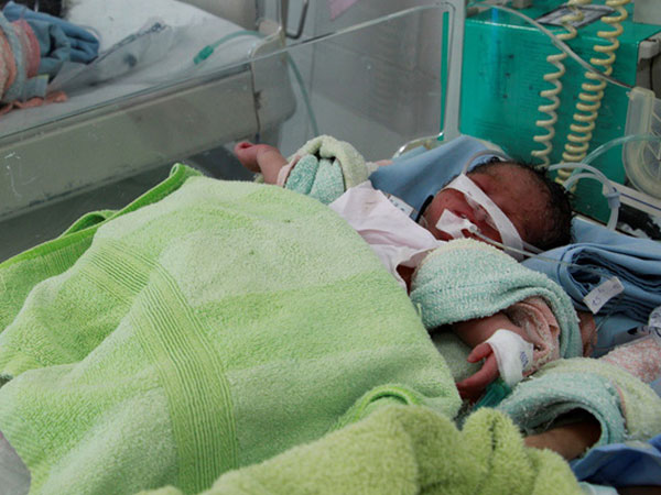 Ảnh bìa bài viết 475678