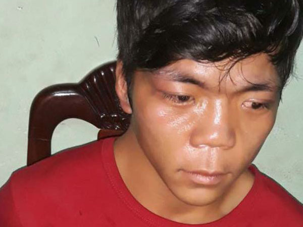 Ảnh bìa bài viết 477083