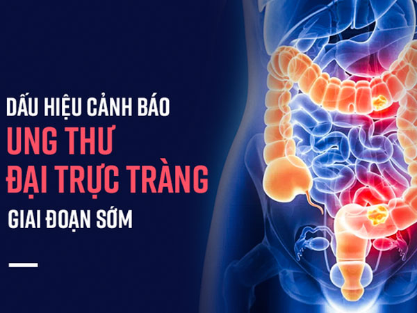 Ảnh bìa bài viết 486674