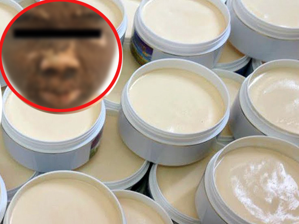 Hí hửng làm đẹp theo trend trên mạng, cô gái tá hỏa khi da mặt bong tróc, thâm đen như 'da trâu'