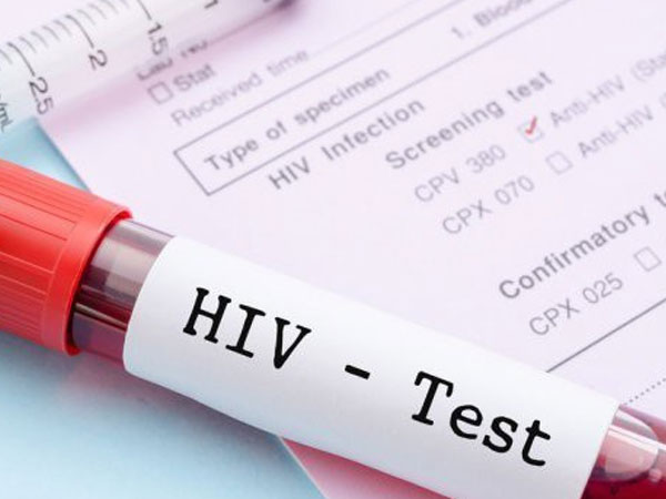 Lần đầu tiên các nhà khoa học loại bỏ được HIV trong toàn bộ gen của chuột: Đem lại hi vọng loại bỏ HIV ở người