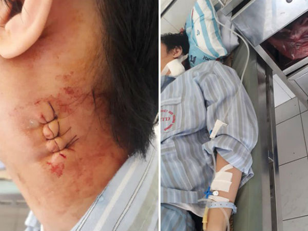Bị 'tố' mổ nhầm cho bệnh nhân gây biến chứng, BV Bạch Mai nói đang khẩn trương xác minh