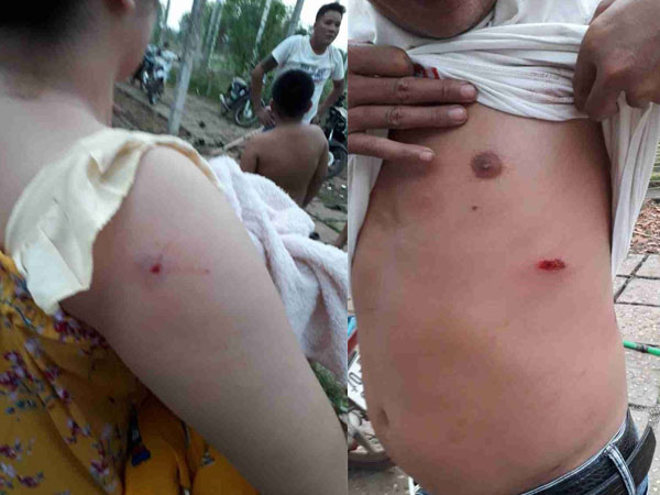 Khởi tố hình sự vụ nhóm giang hồ nổ súng truy sát cả gia đình ở Sài Gòn, bố mẹ và con nhỏ bị bắn thương tích nhiều chỗ