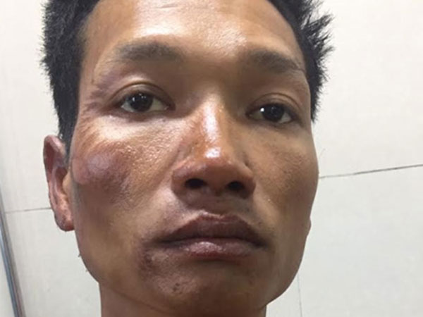 Đốt nhà, dìm vợ chết trong bể nước do cuồng ghen