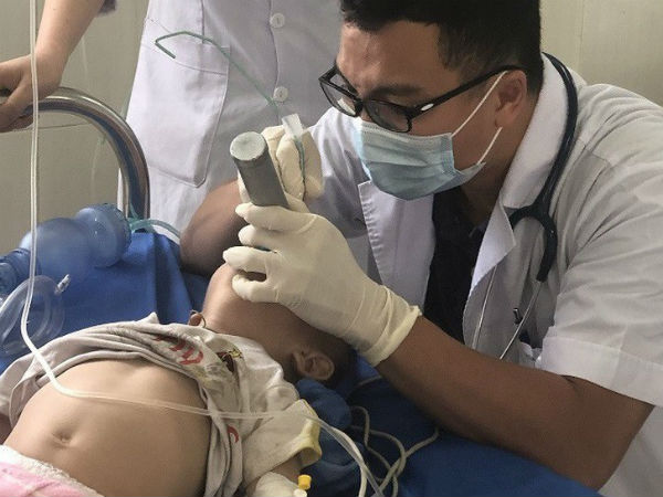 Ngỡ ngàng: Bé trai 12 tháng tuổi suy hô hấp nguy kịch do ngộ độc... thuốc phiện