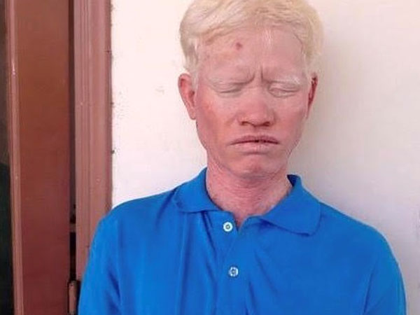 Đánh em trai vỡ sọ não tử vong, lãnh án 14 năm tù giam