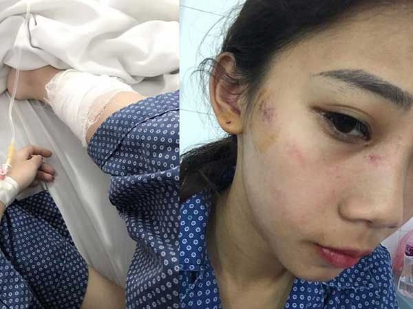 Hà Nội: 2 cô gái trẻ bị nhóm thanh niên trêu ghẹo, hành hung phải nhập viện