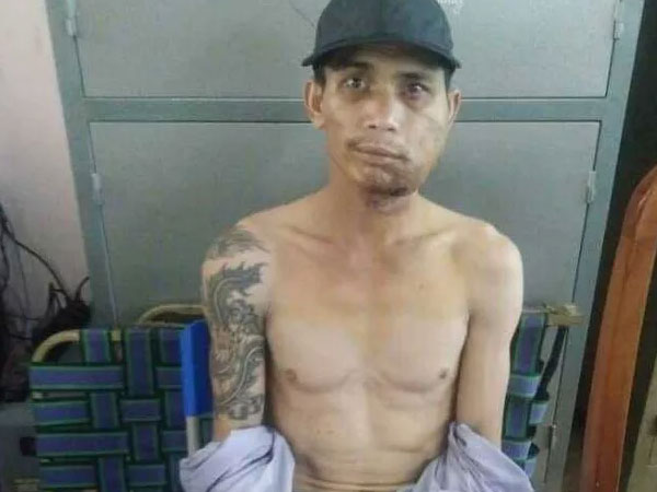 Gã đàn ông bắn người tình rồi bỏ trốn khỏi bệnh viện bị tóm ở Đà Nẵng