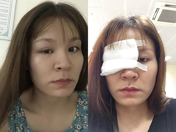 Cô gái tâm sự chuyện lỡ tay làm lọ keo 502 đổ vào mặt, cộng đồng mạng bình luận: 'Chắc là có âm mưu gì đó...'