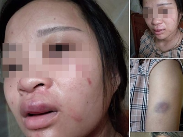 Chồng đánh vợ mang thai tháng thứ 8, nói 'không phải chỉ vì chuyện mua đôi giày'