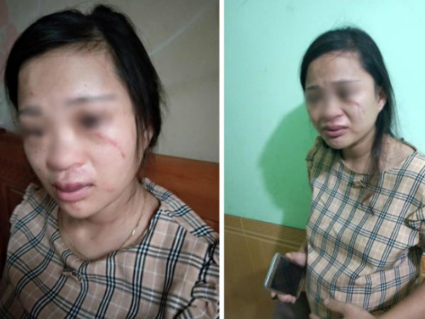 Thông tin mới nhất vụ thai phụ 8 tháng bị chồng đánh đến chảy máu mắt, động thai vì dùng 135 ngàn để mua giày online